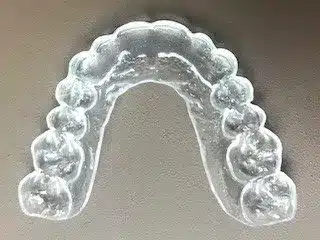 Clear Retainer Mountain View Orthodontics in Longmont and Berthoud, CO