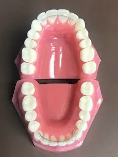 Fixed Bonded Retainers Mountain View Orthodontics in Longmont and Berthoud, CO