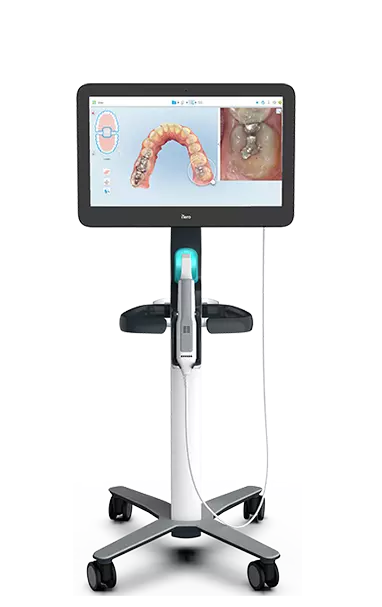 Invisalign iTero intraoral scanner